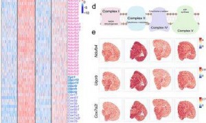 中国科学院最新研究：晚期阿尔茨海默病记忆缺陷或可逆转