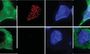 破解十年谜题：科学家首次破解癌症耐药性谜题，锁定染色体碎裂“元凶”