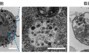 中国科学家，发现抗癌“新利器”