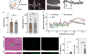 中国科学家研发“神经蚯蚓”：在大脑中无创游走，精准监测神经电信号