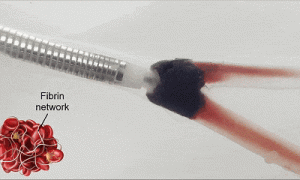 输液时抽出“虾线”状血条！？我还有救吗……